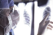 Photo: Surgeons reviewing xray